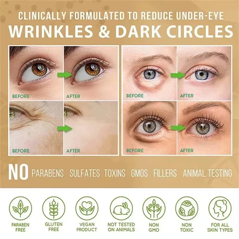 Eye Fat Granules Removal Eyestick Anti-Puffiness Firming Cream anti Inflammatory Fade Fine Line Repair Skin Barrier Skin Care