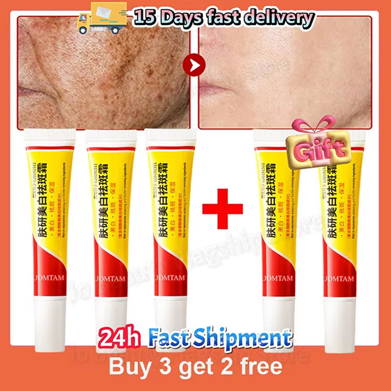 Whitening Freckle Cream Face Brightening Cream Niacinamide Reduce Chloasma Melasma Melanin Fade Fine Lines Lighten Dark Skincare