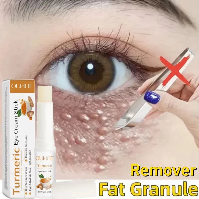Eye Fat Granules Removal Eyestick Anti-Puffiness Firming Cream anti Inflammatory Fade Fine Line Repair Skin Barrier Skin Care