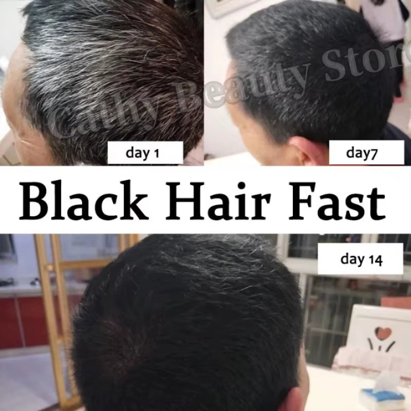 Gray White Hair Treatment Serum Cover White Hair to Black Natural Color Repair Spray anti Loss Hair Restore Healthy Hair Care