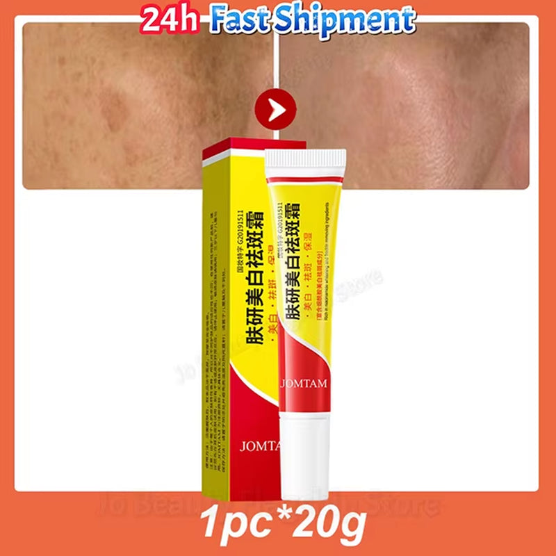 Whitening Freckle Cream Face Brightening Cream Niacinamide Reduce Chloasma Melasma Melanin Fade Fine Lines Lighten Dark Skincare