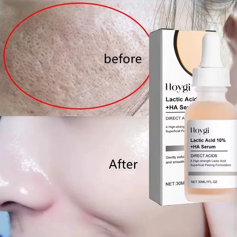 Remove Large Pores Serum Lactic Acid Facial Pore Shrinking Repairing Products Pore Minimizing Firming Smooth Korean Skin Care
