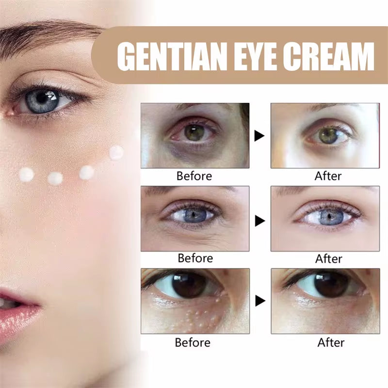 Fat Granules Removal Eye Serum anti Dark Circle Eye Bags Fade Fine Line Essence Anti-Puffiness Moisturizing Skin Care Products