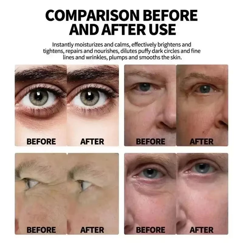 Retinol Anti-Wrinkle Cream for Men Collagen Anti-Aging Removal Face & Neck Wrinkle Efficient Moisturize Firming Korean Skin Care