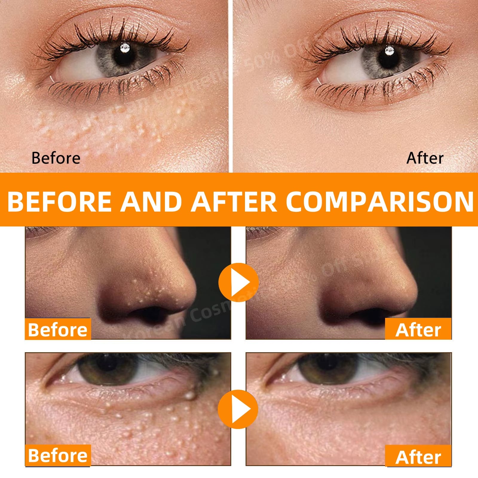 Fat Granules Removal Eye Serum anti Dark Circle Eye Bags Fade Fine Line Essence Anti-Puffiness Moisturizing Skin Care Products