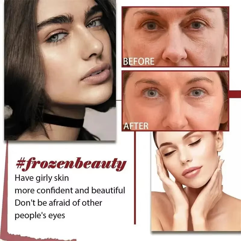 Retinol Wrinkle Removal Facial Kit Instant Firming Enhancement anti Aging Serum Fading Fine Line Whitening Korean Skincare