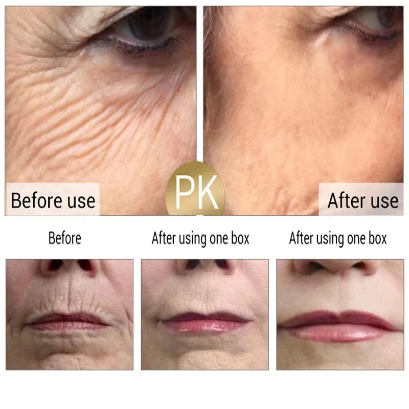 Retinol Wrinkle Remover Face Set Instant Firming Lifting Anti-Aging Serum Fade Fine Lines Whitening Korean Skin Care Product New