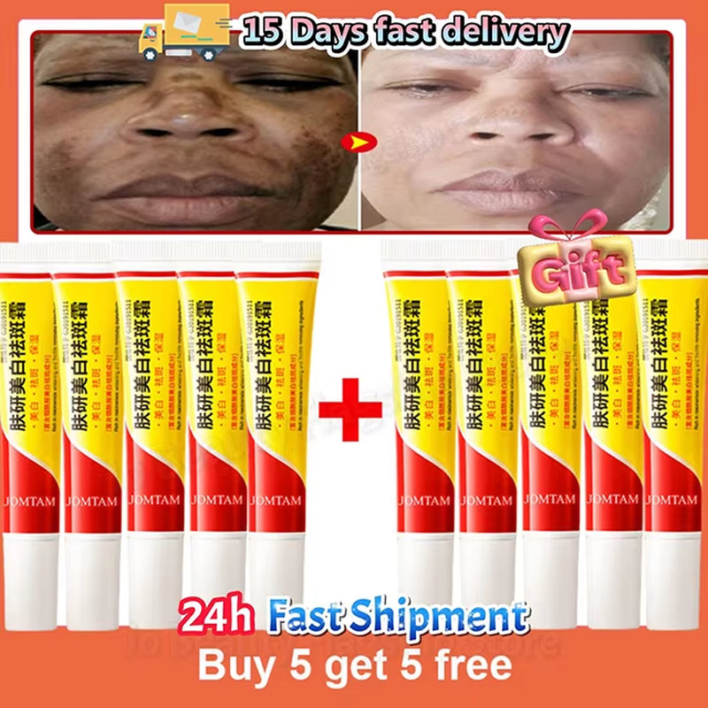 Whitening Freckle Cream Face Brightening Cream Niacinamide Reduce Chloasma Melasma Melanin Fade Fine Lines Lighten Dark Skincare