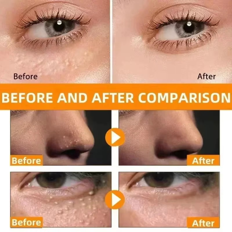Eye Fat Granules Removal Eyestick Anti-Puffiness Firming Cream anti Inflammatory Fade Fine Line Repair Skin Barrier Skin Care